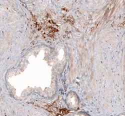 Invitrogen HAS3 Polyclonal Antibody 100 &mu;L; Unconjugated:Antibodies,