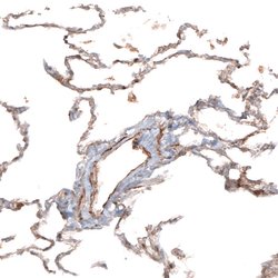 Invitrogen HAS3 Polyclonal Antibody 100 &mu;L; Unconjugated:Antibodies,