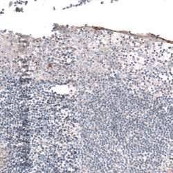 Invitrogen HAS3 Polyclonal Antibody 100 &mu;L; Unconjugated:Antibodies,