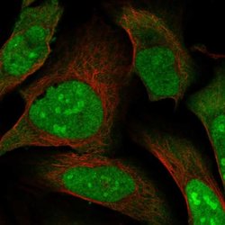 MAGED2 Polyclonal Antibody:Antibodies, Polyclonal