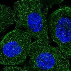 Invitrogen Synaptojanin 2 Polyclonal Antibody 100 &mu;L; Unconjugated:Antibodies,