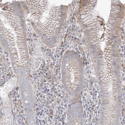 DCDC2 Polyclonal Antibody:Antibodies, Polyclonal