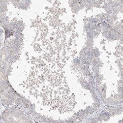 DCDC2 Polyclonal Antibody:Antibodies, Polyclonal