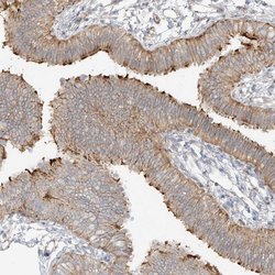 DCDC2 Polyclonal Antibody:Antibodies, Polyclonal