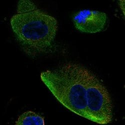 DCDC2 Polyclonal Antibody:Antibodies, Polyclonal