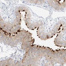 Invitrogen DCDC2 Polyclonal Antibody 100 &mu;L; Unconjugated:Antibodies,