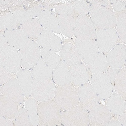 Invitrogen DCDC2 Polyclonal Antibody 100 &mu;L; Unconjugated:Antibodies,