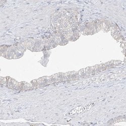 Invitrogen DCDC2 Polyclonal Antibody 100 &mu;L; Unconjugated:Antibodies,