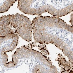 Invitrogen DCDC2 Polyclonal Antibody 100 &mu;L; Unconjugated:Antibodies,