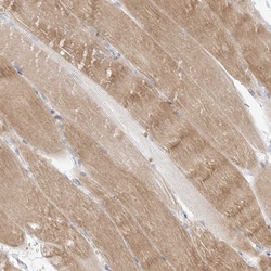 Invitrogen SLC2A12 Polyclonal Antibody 100 &mu;L; Unconjugated:Antibodies,