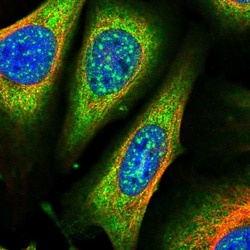 Invitrogen ARHGAP18 Polyclonal Antibody 100 &mu;L | Buy Online | Invitrogen&trade; | Fisher Scientific