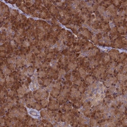 Invitrogen ARHGAP18 Polyclonal Antibody 100 &mu;L | Buy Online | Invitrogen&trade; | Fisher Scientific
