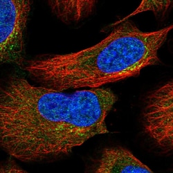 ASCC3 Polyclonal Antibody:Antibodies, Polyclonal