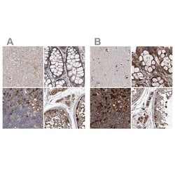 ASCC3 Polyclonal Antibody:Antibodies, Polyclonal