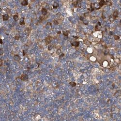 ASCC3 Polyclonal Antibody:Antibodies, Polyclonal