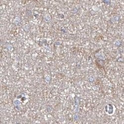 ASCC3 Polyclonal Antibody:Antibodies, Polyclonal