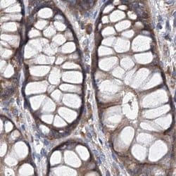 ASCC3 Polyclonal Antibody:Antibodies, Polyclonal
