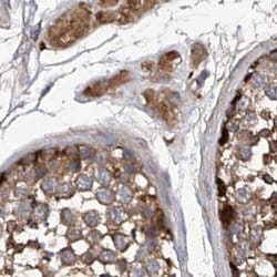 ASCC3 Polyclonal Antibody:Antibodies, Polyclonal