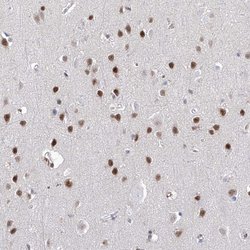 Invitrogen Atrophin 1 Polyclonal Antibody 100 &mu;L | Buy Online | Invitrogen&trade; | Fisher Scientific
