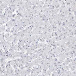 Invitrogen Atrophin 1 Polyclonal Antibody 100 &mu;L | Buy Online | Invitrogen&trade; | Fisher Scientific