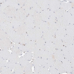 Invitrogen POGK Polyclonal Antibody 100 &mu;L; Unconjugated:Antibodies,