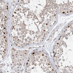 Invitrogen POGK Polyclonal Antibody 100 &mu;L; Unconjugated:Antibodies,