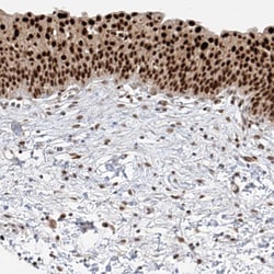 Invitrogen POGK Polyclonal Antibody 100 &mu;L; Unconjugated:Antibodies,