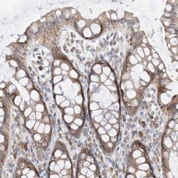 Invitrogen PPA2 Polyclonal Antibody 100 &mu;L; Unconjugated:Antibodies,
