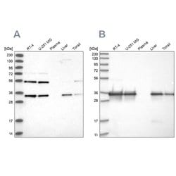 Invitrogen PPA2 Polyclonal Antibody 100 &mu;L; Unconjugated:Antibodies,