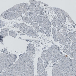 Invitrogen RSPH9 Polyclonal Antibody 100 &mu;L; Unconjugated:Antibodies,