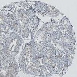 Invitrogen RSPH9 Polyclonal Antibody 100 &mu;L; Unconjugated:Antibodies,