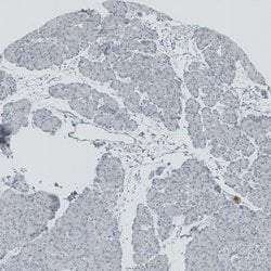 Invitrogen RSPH9 Polyclonal Antibody 100 &mu;L; Unconjugated:Antibodies,
