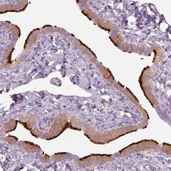 Invitrogen RSPH9 Polyclonal Antibody 100 &mu;L; Unconjugated:Antibodies,