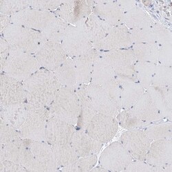 Invitrogen REC8 Polyclonal Antibody 100 &mu;L; Unconjugated:Antibodies,