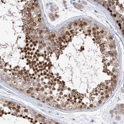 Invitrogen REC8 Polyclonal Antibody 100 &mu;L; Unconjugated:Antibodies,