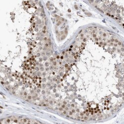 Invitrogen REC8 Polyclonal Antibody 100 &mu;L; Unconjugated:Antibodies,