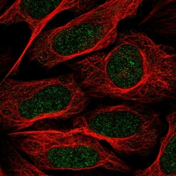 Invitrogen TAF8 Polyclonal Antibody 100 &mu;L; Unconjugated:Antibodies,