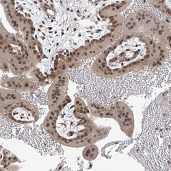 Invitrogen TAF8 Polyclonal Antibody 100 &mu;L; Unconjugated:Antibodies,