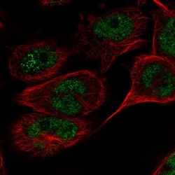Invitrogen TAF8 Polyclonal Antibody 100 &mu;L; Unconjugated:Antibodies,