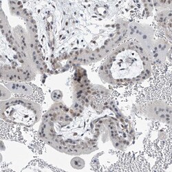 Invitrogen TAF8 Polyclonal Antibody 100 &mu;L; Unconjugated:Antibodies,