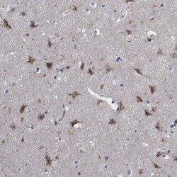 Invitrogen TTBK1 Polyclonal Antibody 100 &mu;L; Unconjugated:Antibodies,