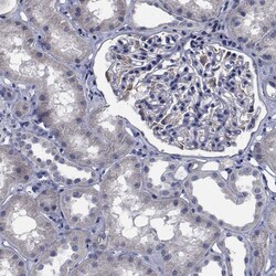 Invitrogen TTBK1 Polyclonal Antibody 100 &mu;L; Unconjugated:Antibodies,