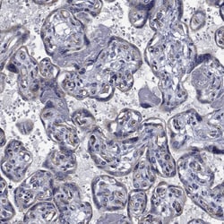 Invitrogen TTBK1 Polyclonal Antibody 100 &mu;L; Unconjugated:Antibodies,