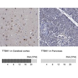 Invitrogen TTBK1 Polyclonal Antibody 100 &mu;L; Unconjugated:Antibodies,