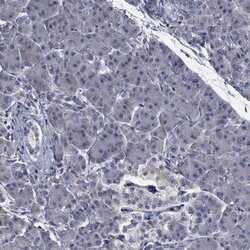 Invitrogen TTBK1 Polyclonal Antibody 100 &mu;L; Unconjugated:Antibodies,