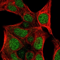 Invitrogen COLGALT2 Polyclonal Antibody 100 &mu;L; Unconjugated:Antibodies,