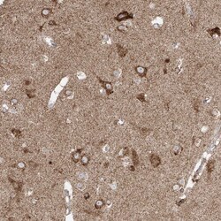 Invitrogen COLGALT2 Polyclonal Antibody 100 &mu;L; Unconjugated:Antibodies,