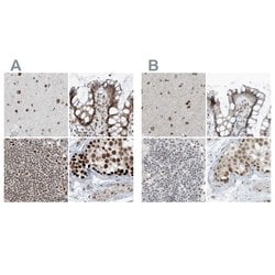 Invitrogen WHIP Polyclonal Antibody 100 &mu;L; Unconjugated:Antibodies,
