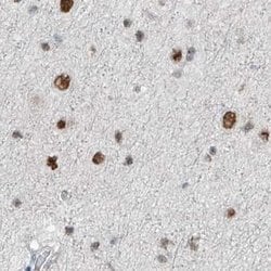Invitrogen WHIP Polyclonal Antibody 100 &mu;L; Unconjugated:Antibodies,