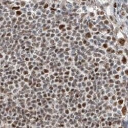 Invitrogen WHIP Polyclonal Antibody 100 &mu;L; Unconjugated:Antibodies,